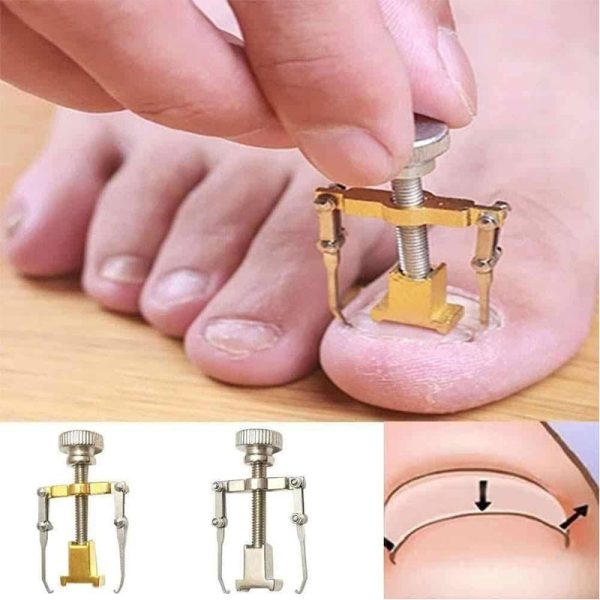 محصول ابزار ارتودنسی ناخن
