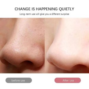 اتو پاکسازی صورت